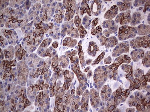 Acidic Cytokeratin Antibody in Immunohistochemistry (Paraffin) (IHC (P))