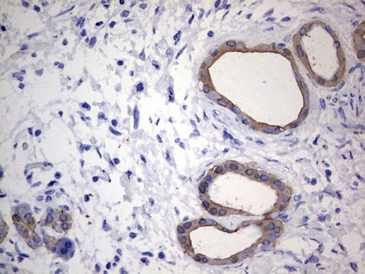 Acidic Cytokeratin Antibody in Immunohistochemistry (Paraffin) (IHC (P))