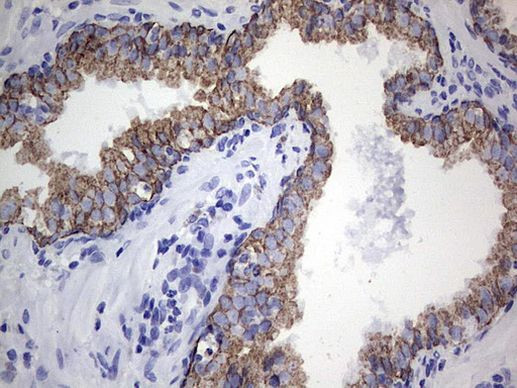 Acidic Cytokeratin Antibody in Immunohistochemistry (Paraffin) (IHC (P))