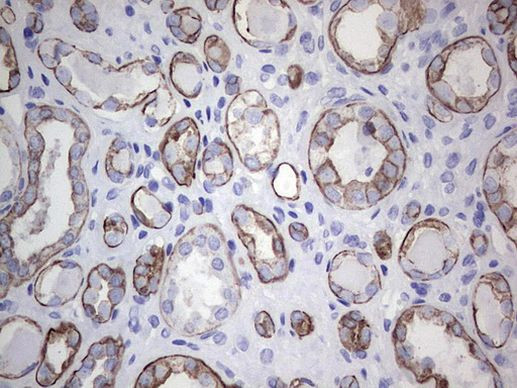 Acidic Cytokeratin Antibody in Immunohistochemistry (Paraffin) (IHC (P))