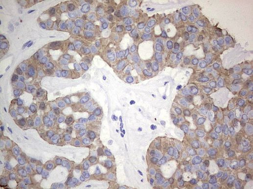 Acidic Cytokeratin Antibody in Immunohistochemistry (Paraffin) (IHC (P))