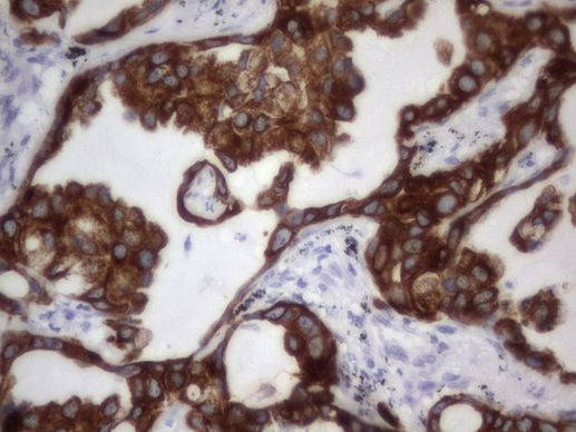 Acidic Cytokeratin Antibody in Immunohistochemistry (Paraffin) (IHC (P))