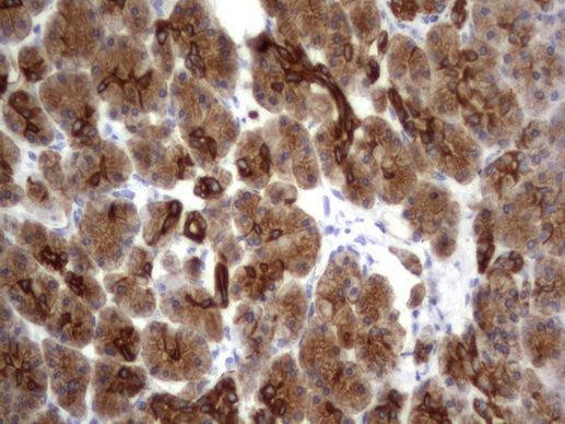 Acidic Cytokeratin Antibody in Immunohistochemistry (Paraffin) (IHC (P))