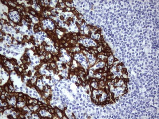 Acidic Cytokeratin Antibody in Immunohistochemistry (Paraffin) (IHC (P))