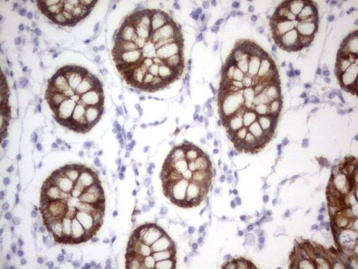 Acidic Cytokeratin Antibody in Immunohistochemistry (Paraffin) (IHC (P))