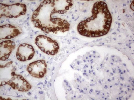 Acidic Cytokeratin Antibody in Immunohistochemistry (Paraffin) (IHC (P))