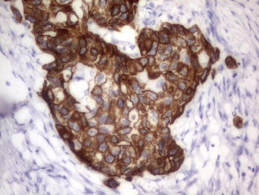 Acidic Cytokeratin Antibody in Immunohistochemistry (Paraffin) (IHC (P))