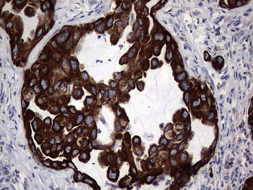 Acidic Cytokeratin Antibody in Immunohistochemistry (Paraffin) (IHC (P))