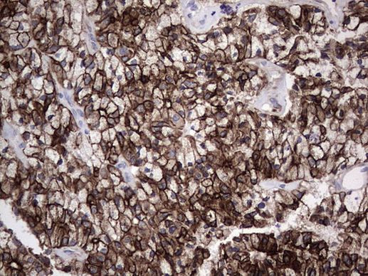 Acidic Cytokeratin Antibody in Immunohistochemistry (Paraffin) (IHC (P))