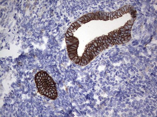 Acidic Cytokeratin Antibody in Immunohistochemistry (Paraffin) (IHC (P))