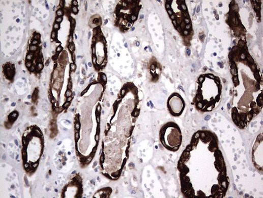 Acidic Cytokeratin Antibody in Immunohistochemistry (Paraffin) (IHC (P))