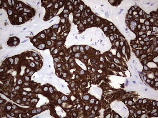 Acidic Cytokeratin Antibody in Immunohistochemistry (Paraffin) (IHC (P))