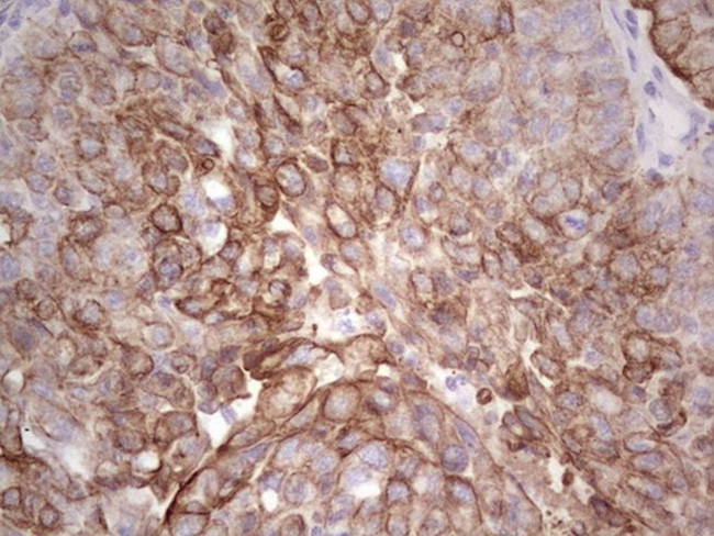 Acidic Cytokeratin Antibody in Immunohistochemistry (Paraffin) (IHC (P))