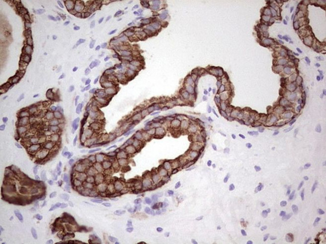 Acidic Cytokeratin Antibody in Immunohistochemistry (Paraffin) (IHC (P))