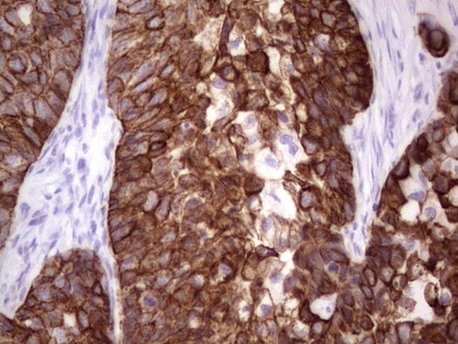 Acidic Cytokeratin Antibody in Immunohistochemistry (Paraffin) (IHC (P))