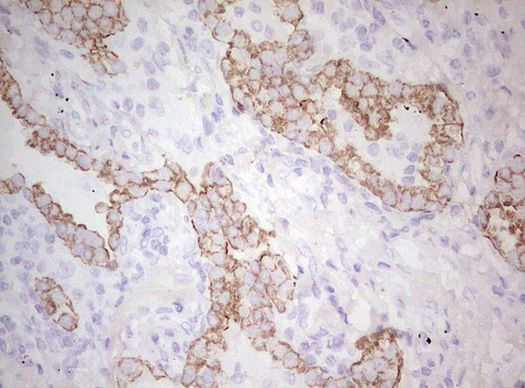 Basic Cytokeratin Antibody in Immunohistochemistry (Paraffin) (IHC (P))