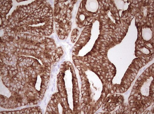 Basic Cytokeratin Antibody in Immunohistochemistry (Paraffin) (IHC (P))