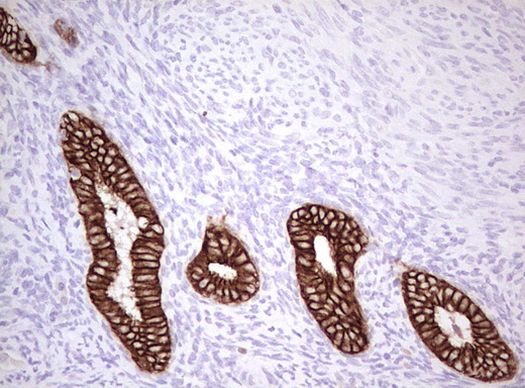 Basic Cytokeratin Antibody in Immunohistochemistry (Paraffin) (IHC (P))