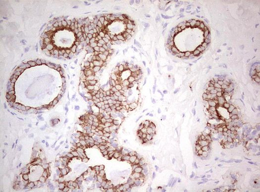 Basic Cytokeratin Antibody in Immunohistochemistry (Paraffin) (IHC (P))