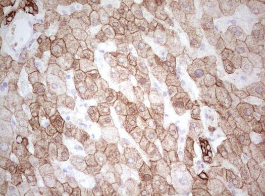 Basic Cytokeratin Antibody in Immunohistochemistry (Paraffin) (IHC (P))