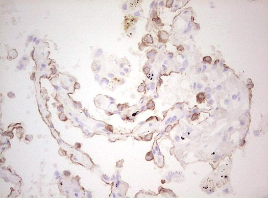 Basic Cytokeratin Antibody in Immunohistochemistry (Paraffin) (IHC (P))