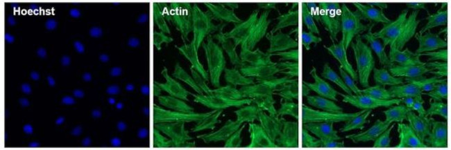 Actin Antibody in Immunocytochemistry (ICC/IF)