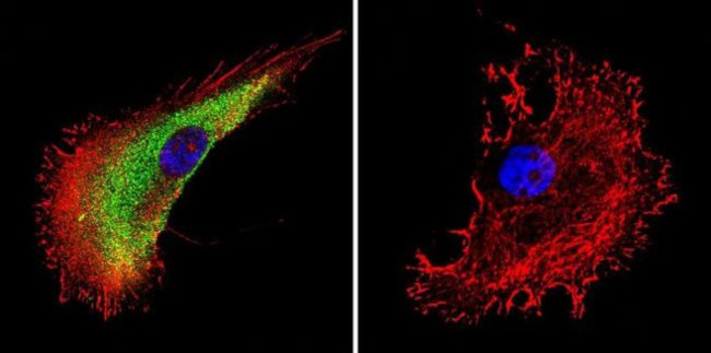 Actin Antibody in Immunocytochemistry (ICC/IF)