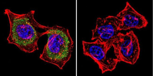 Actin Antibody in Immunocytochemistry (ICC/IF)