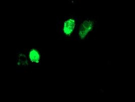 Adiponectin Antibody in Immunocytochemistry (ICC/IF)