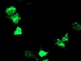 Adiponectin Antibody in Immunocytochemistry (ICC/IF)