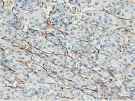 Adiponectin Antibody in Immunohistochemistry (Paraffin) (IHC (P))