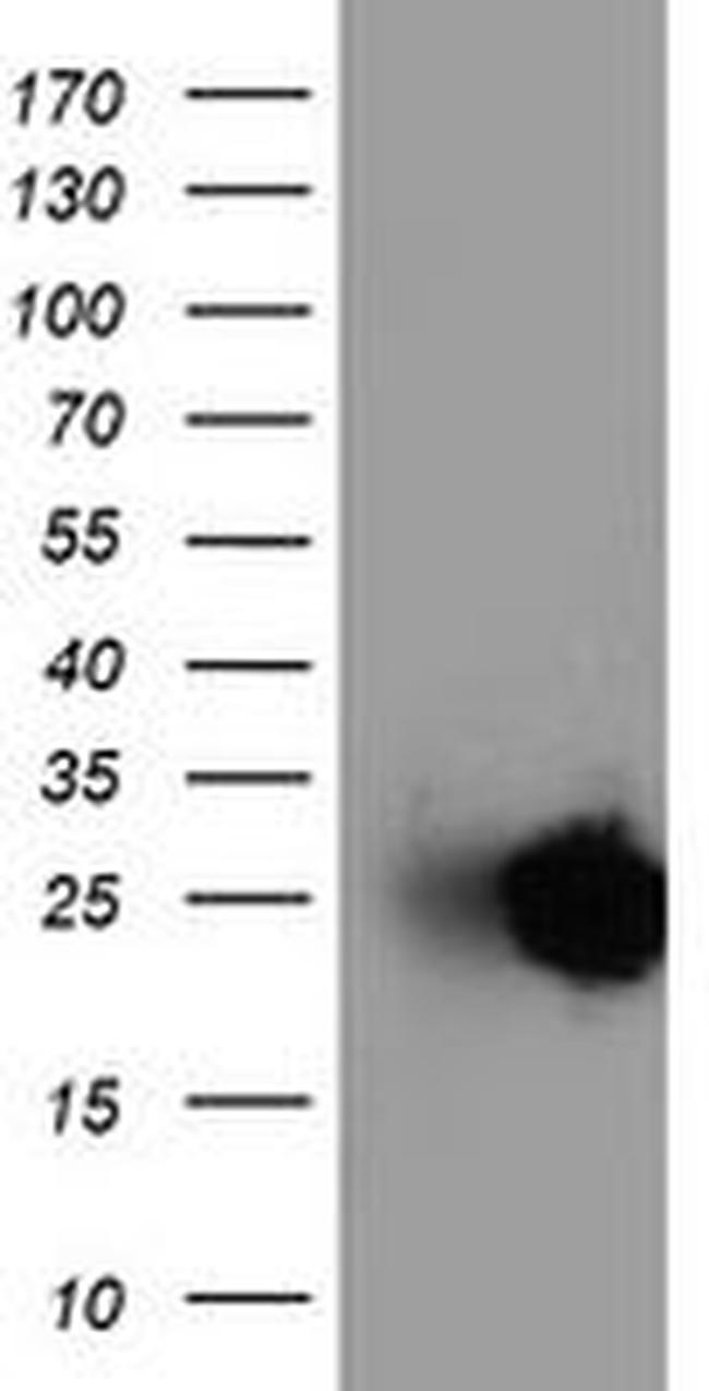 Adiponectin Antibody in Western Blot (WB)