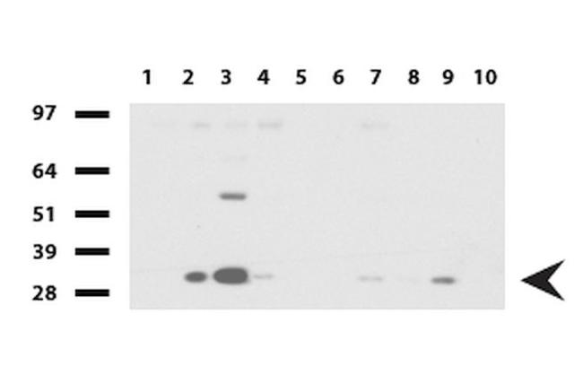 Adiponectin Antibody in Western Blot (WB)