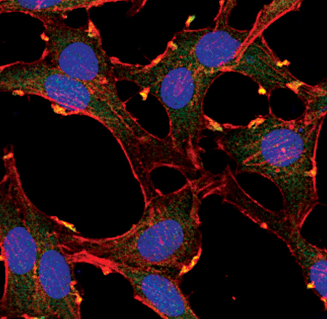 AKT Pan Antibody in Immunocytochemistry (ICC/IF)