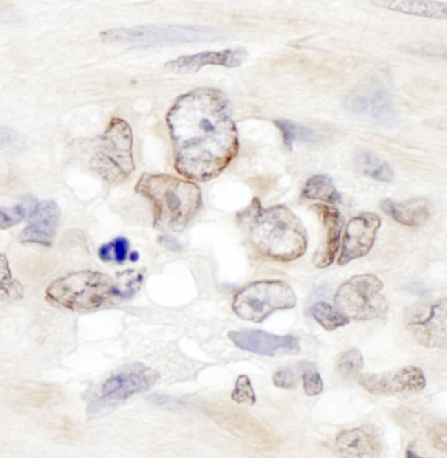 Aladin Antibody in Immunohistochemistry (IHC)