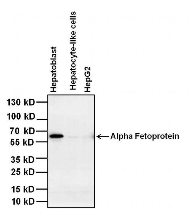 AFP Antibody in Western Blot (WB)