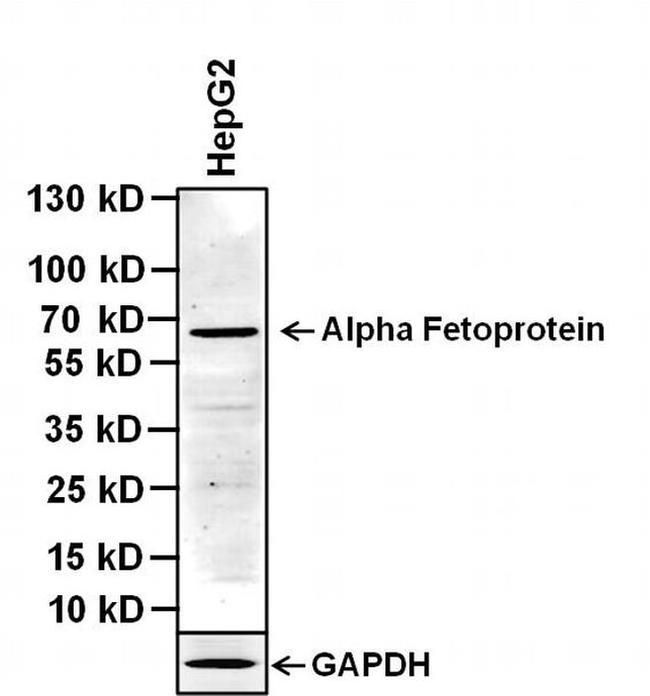 AFP Antibody in Western Blot (WB)