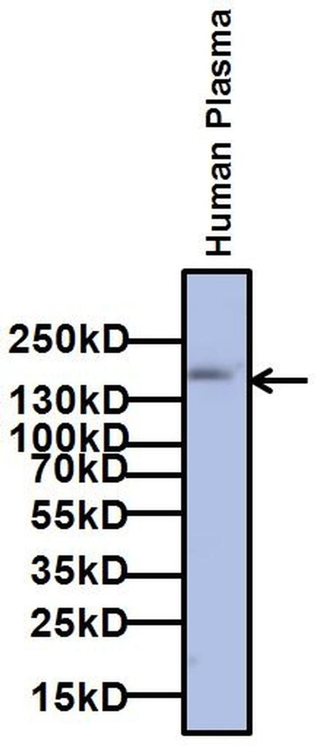 A2M Antibody in Western Blot (WB)