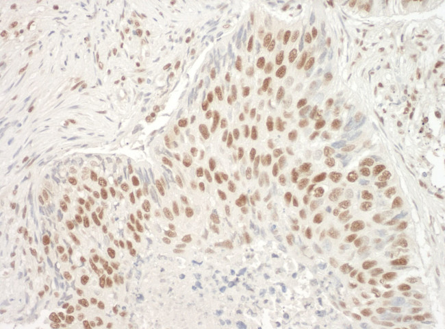 Aly Antibody in Immunohistochemistry (IHC)