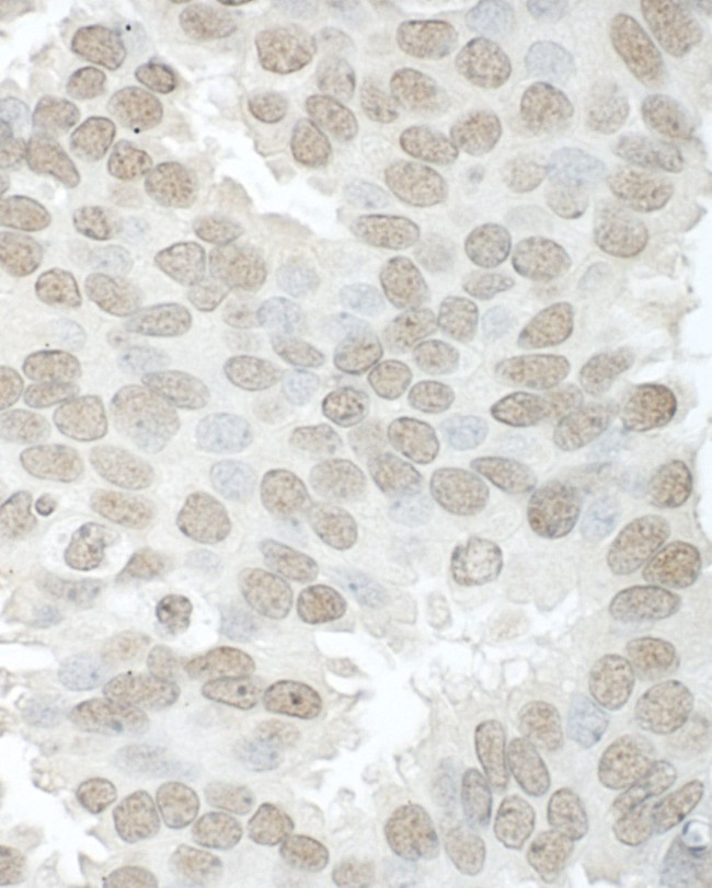 Aly Antibody in Immunohistochemistry (IHC)