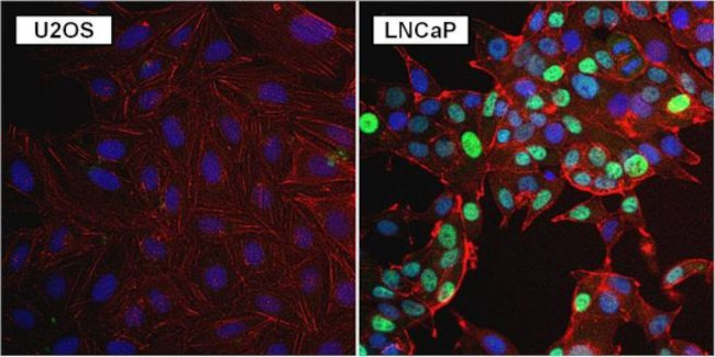 Androgen Receptor Antibody in Immunocytochemistry (ICC/IF)