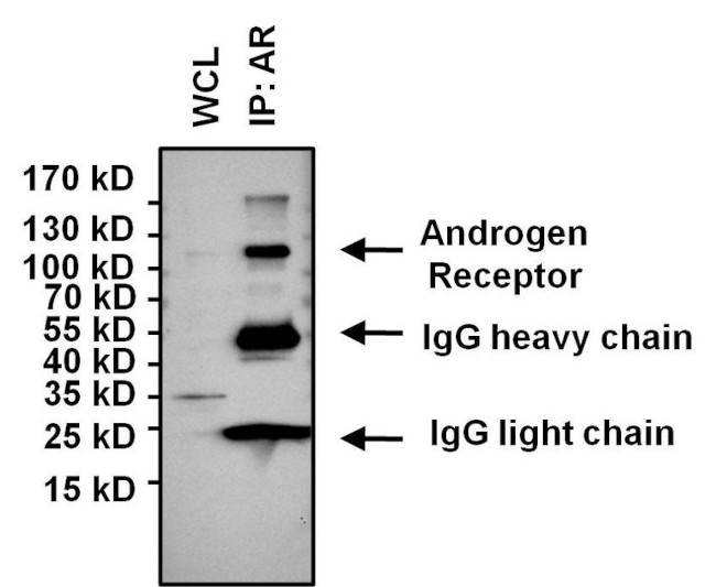 Androgen Receptor Antibody in Immunoprecipitation (IP)