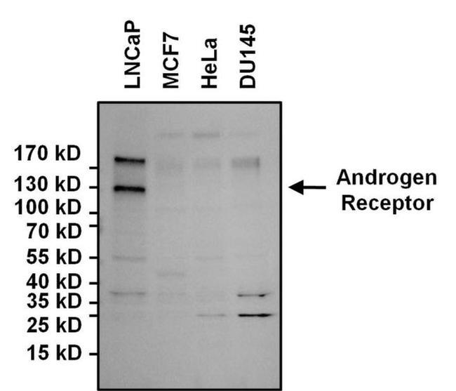 Androgen Receptor Antibody in Western Blot (WB)