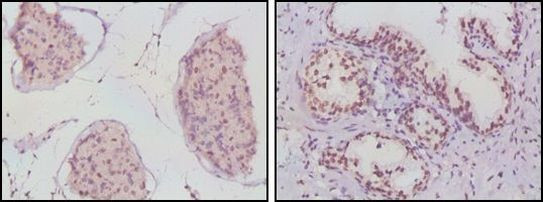 Androgen Receptor Antibody in Immunohistochemistry (Paraffin) (IHC (P))