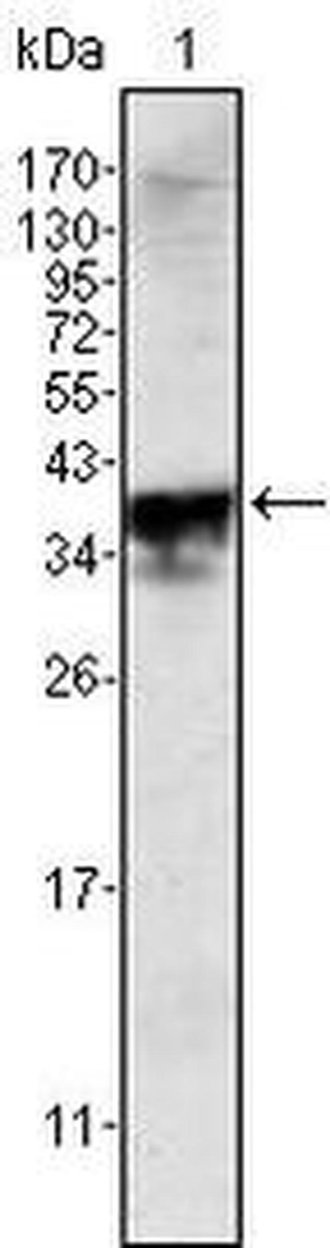 Androgen Receptor Antibody in Western Blot (WB)