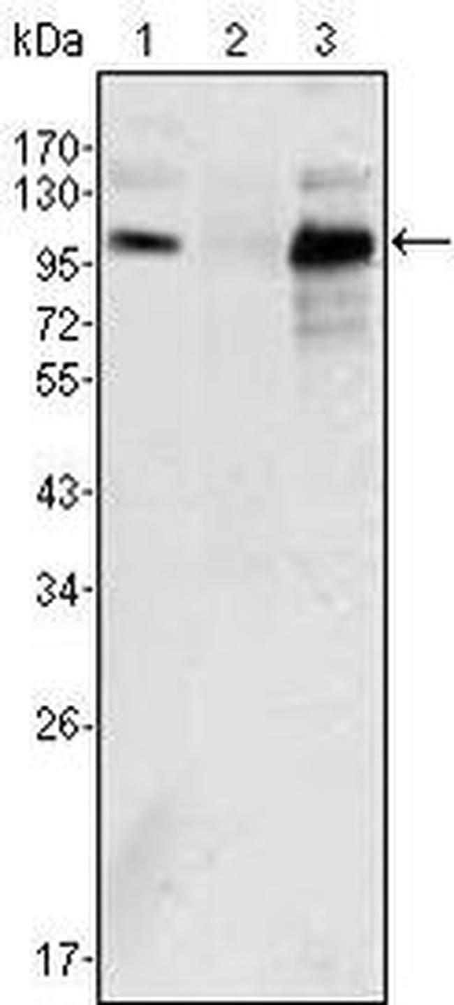 Androgen Receptor Antibody in Western Blot (WB)