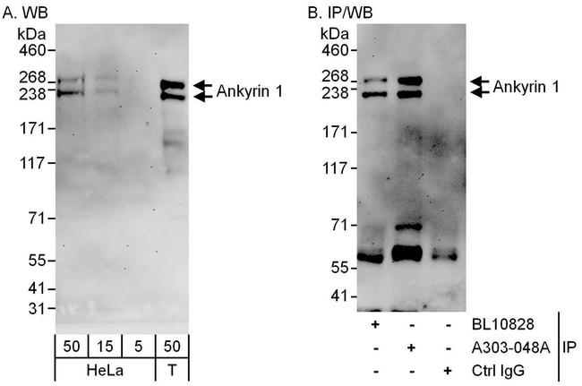 Ankyrin 1 Antibody in Western Blot (WB)