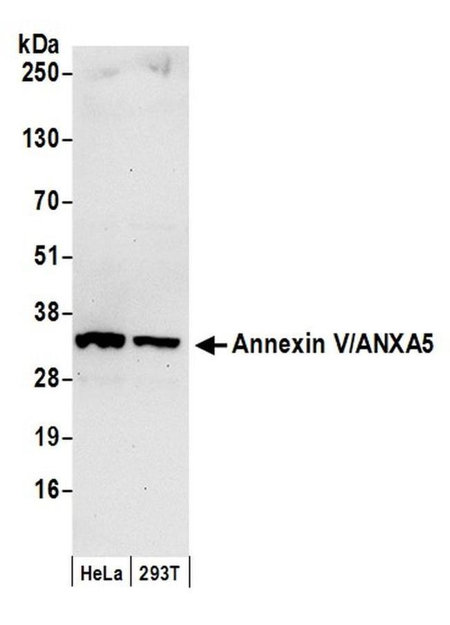 Annexin V/ANXA5 Antibody in Western Blot (WB)