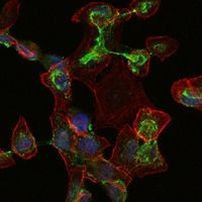 Apolipoprotein B Antibody in Immunocytochemistry (ICC/IF)