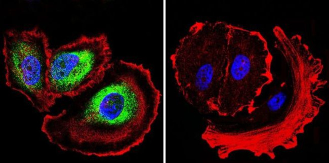 ARF6 Antibody in Immunocytochemistry (ICC/IF)